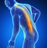 spinal cord injuries, Wisconsin Personal Injury Lawyer