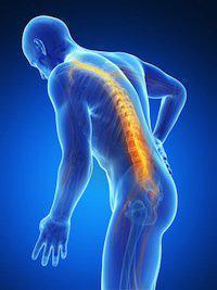 spinal cord injuries, Wisconsin Personal Injury Lawyer
